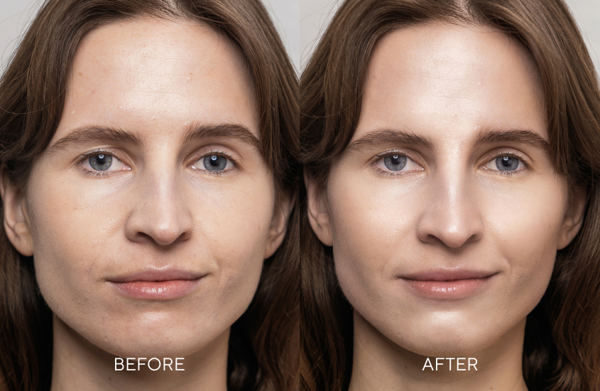 Model with and without CC Cream on her face